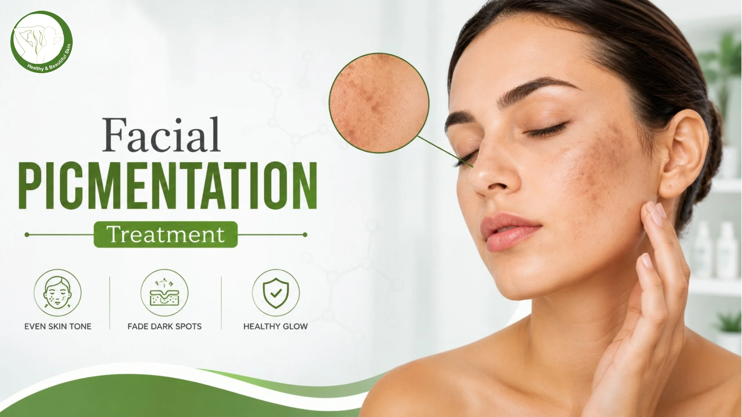 Facial Pigmentation permanent relief in Palwal, Haryana 2026